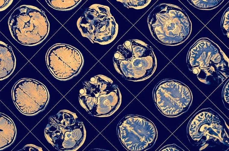 An MR image of the human brain. Image Credit: Arizona College of Medicine – Phoenix